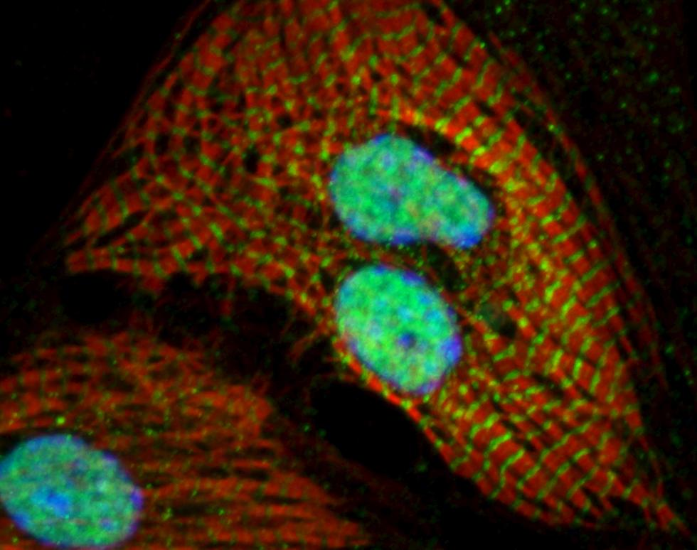 Rat heart muscle cell - HDAC1 and beta MHC staining